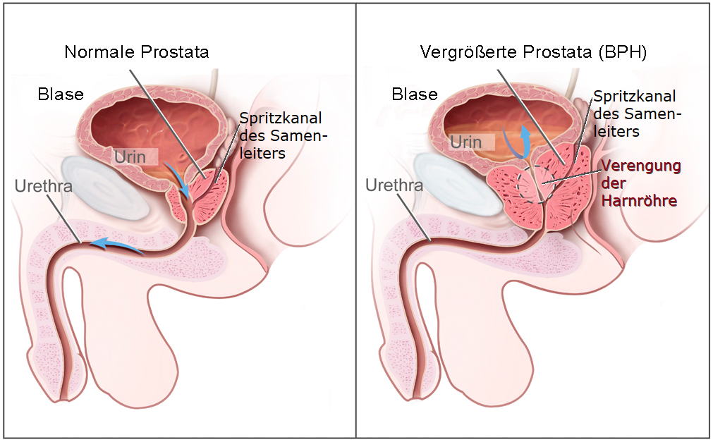 was macht die prostata